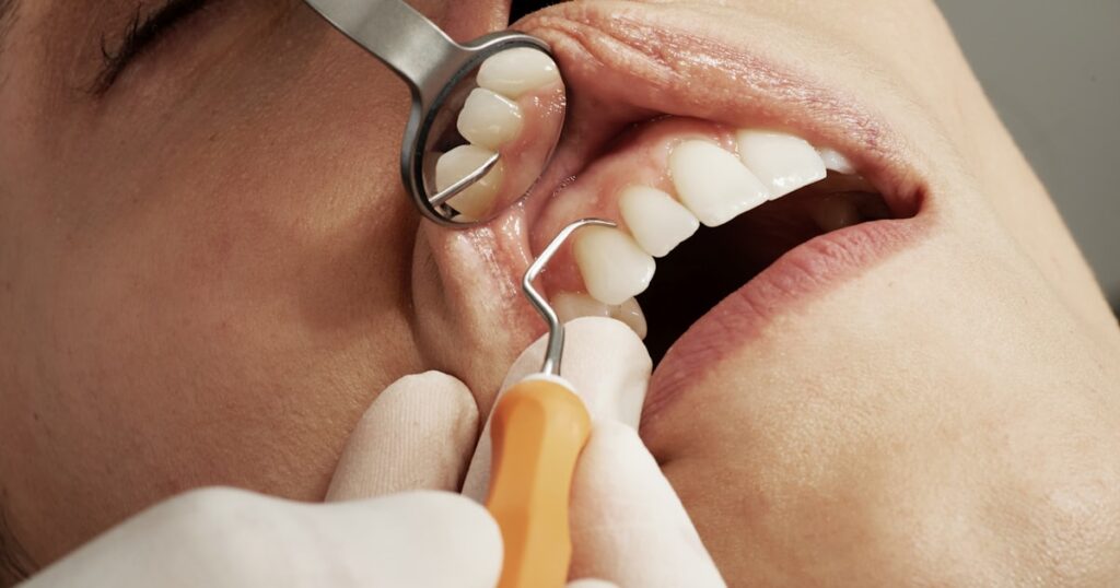 Dental implant procedure at Lagos clinic